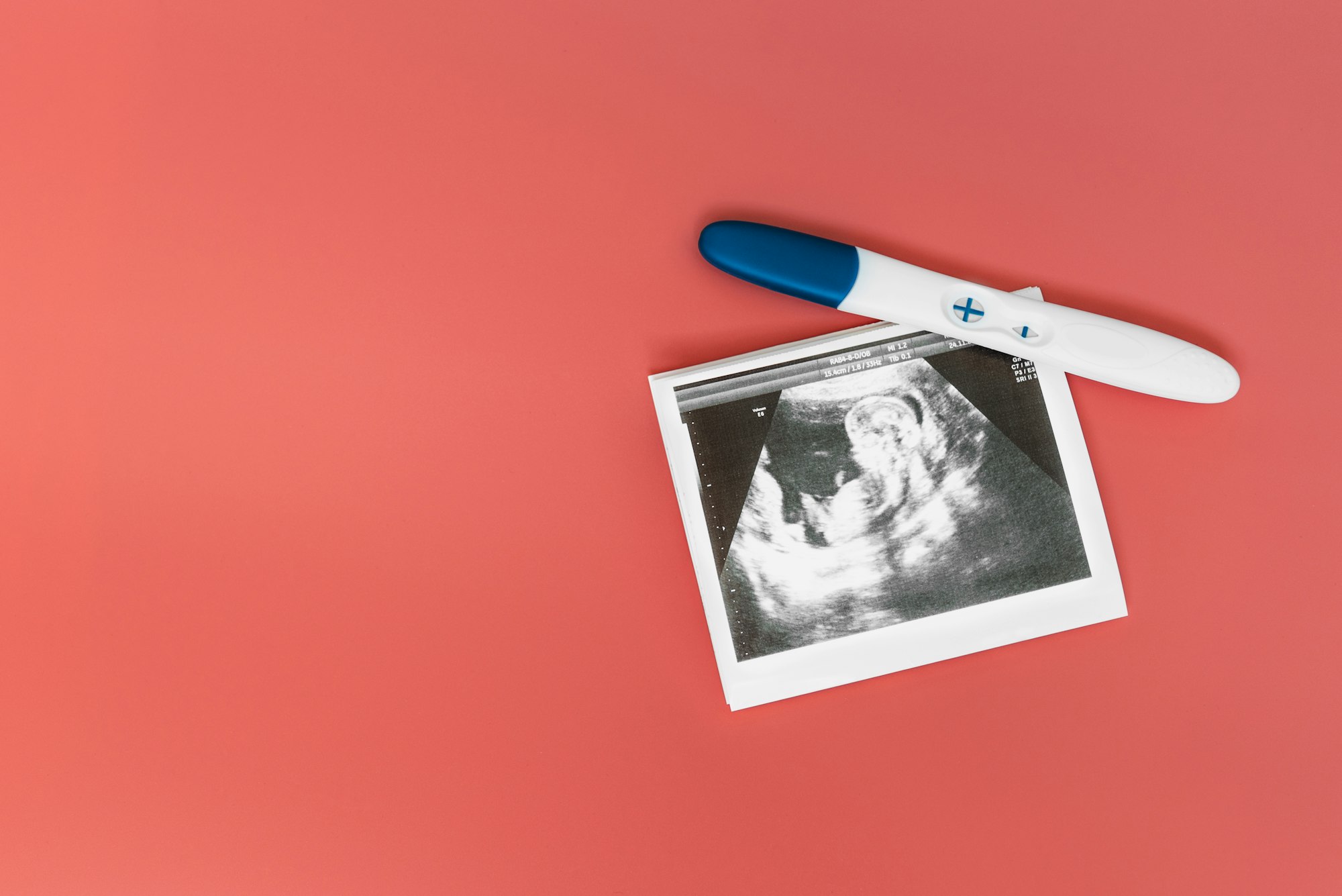 A positive pregnancy test and ultrasound photo on a pink background